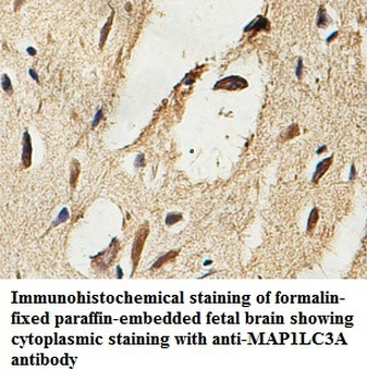 MAP1LC3A Rabbit Polyclonal Antibody
