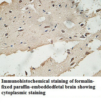 ECE2 Rabbit Polyclonal Antibody