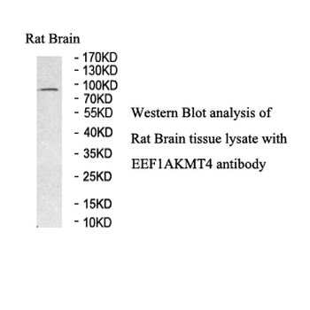 ECE2 Rabbit Polyclonal Antibody