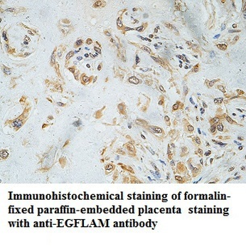 EGFLAM Rabbit Polyclonal Antibody