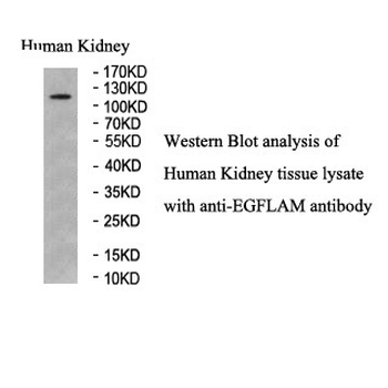 EGFLAM Rabbit Polyclonal Antibody