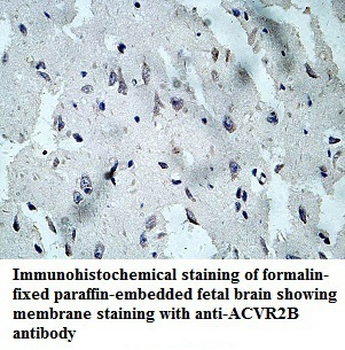 ACVR2B Rabbit Polyclonal Antibody