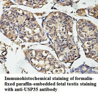 USP35 Rabbit Polyclonal Antibody