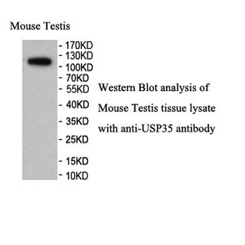 USP35 Rabbit Polyclonal Antibody