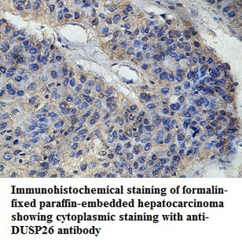 DUSP26 Rabbit Polyclonal Antibody