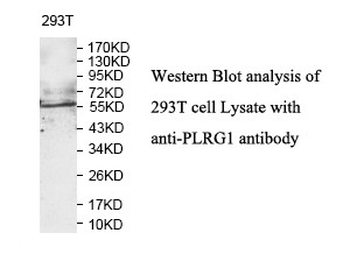 PLRG1 Rabbit Polyclonal Antibody