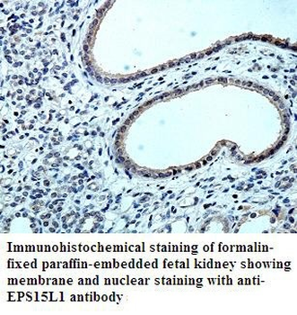 EPS15L1 Rabbit Polyclonal Antibody