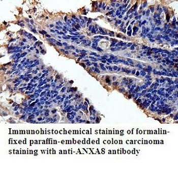 ANXA8 Rabbit Polyclonal Antibody