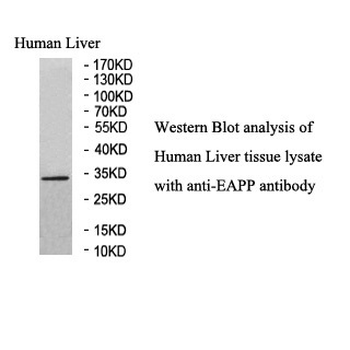 EAPP Rabbit Polyclonal Antibody