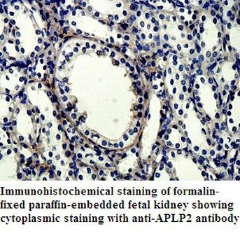 APLP2 Rabbit Polyclonal Antibody