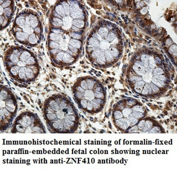 ZNF410 Rabbit Polyclonal Antibody