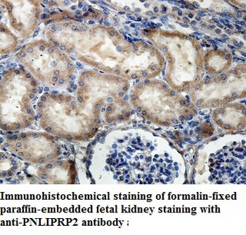 PNLIPRP2 Rabbit Polyclonal Antibody