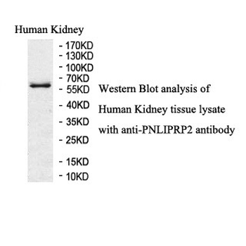 PNLIPRP2 Rabbit Polyclonal Antibody