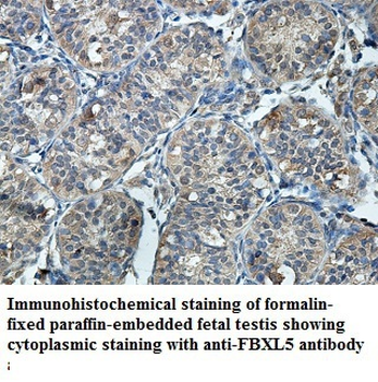 FBXL5 Rabbit Polyclonal Antibody