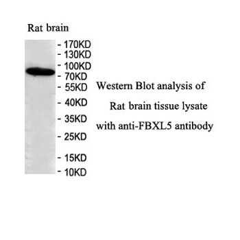 FBXL5 Rabbit Polyclonal Antibody