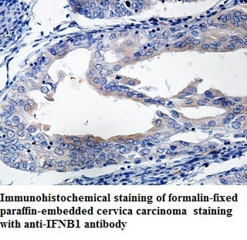 IFNB1 Rabbit Polyclonal Antibody