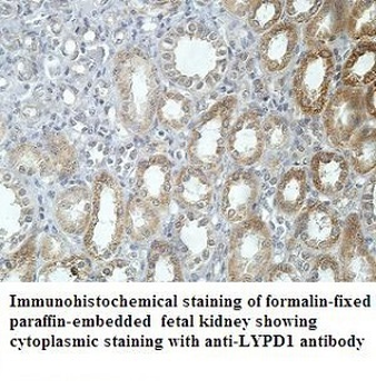 LYPD1 Rabbit Polyclonal Antibody
