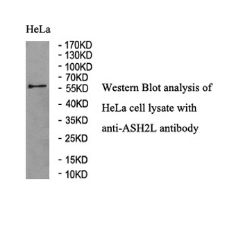 ASH2L Rabbit Polyclonal Antibody