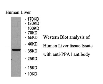 PPA1 Rabbit Polyclonal Antibody