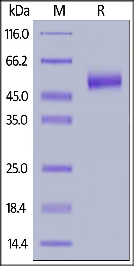 Human IL-13 R alpha 2 Protein, His Tag