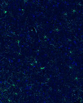 Guinea pig anti-GFAP Antibody