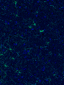 Chicken anti-GFAP Antibody