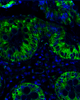 Goat anti-alpha Actinin-4 Antibody