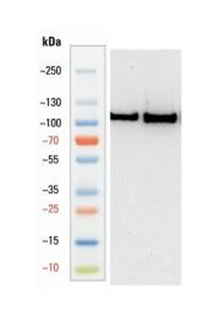 Goat anti-alpha Actinin-4 Antibody