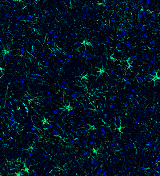 Goat anti-GFAP Antibody
