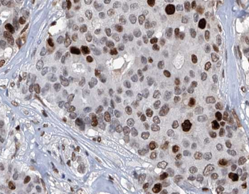 L-Lactyl-Histone H3 (Lys27)/H3K27la Antibody