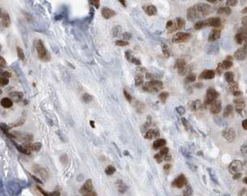 L-Lactyl-Histone H3 (Lys23)/H3K23la Antibody