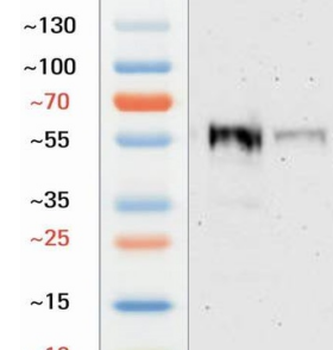 Chicken Tubulin beta 3 Antibody