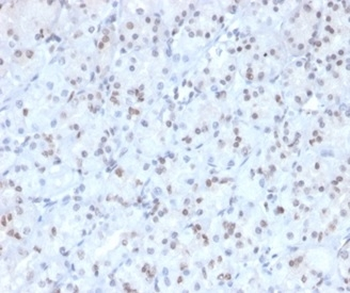 MGMT Antibody