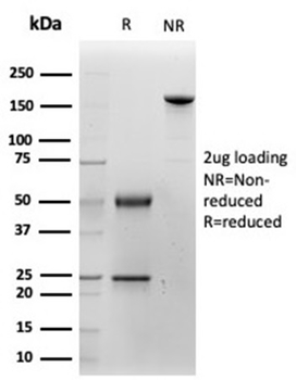 KRT14 Antibody