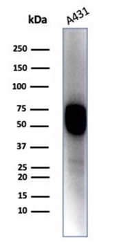 KRT14 Antibody