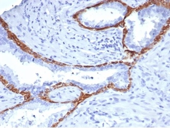 KRT14 Antibody
