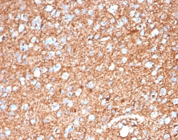 GFAP Antibody