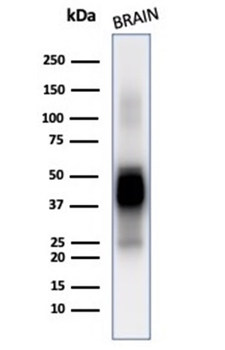 GFAP Antibody