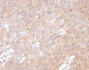 IL-6 Antibody