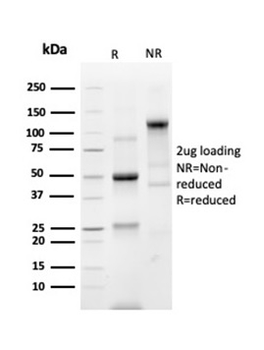 SLC45A3 Antibody