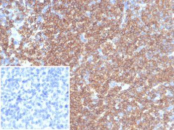 Recombinant CD45RA / LCA (B-Cell Marker) Antibody