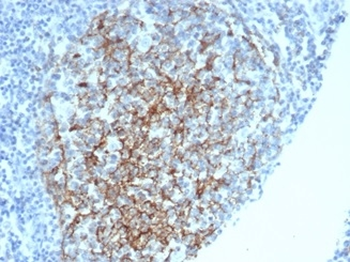CR1 Antibody