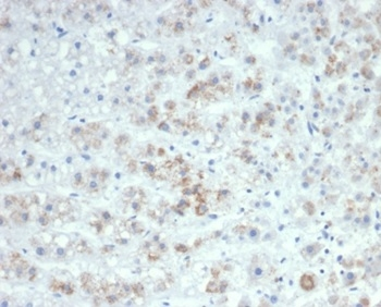 IL-6 Antibody