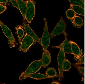 ZNF276 Antibody