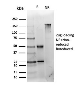 HDAC3 Antibody