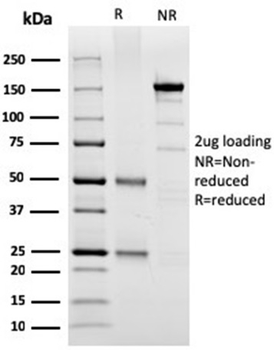 SPARC Antibody