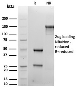 Recombinant CD138 / Syndecan-1 (SDC1) (Plasma Cell Marker) Antibody