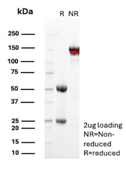 CD138 / Syndecan-1 (SDC1) (Plasma Cell Marker) Antibody