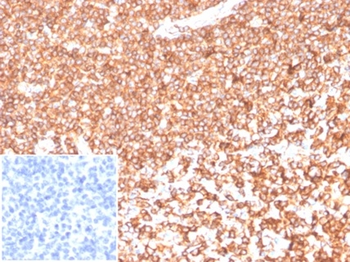 ACTB Antibody