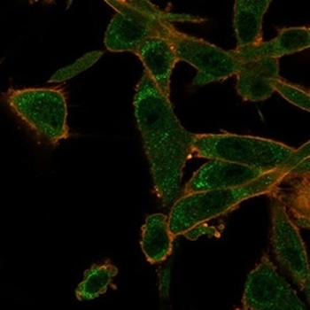 ZNF562 Antibody